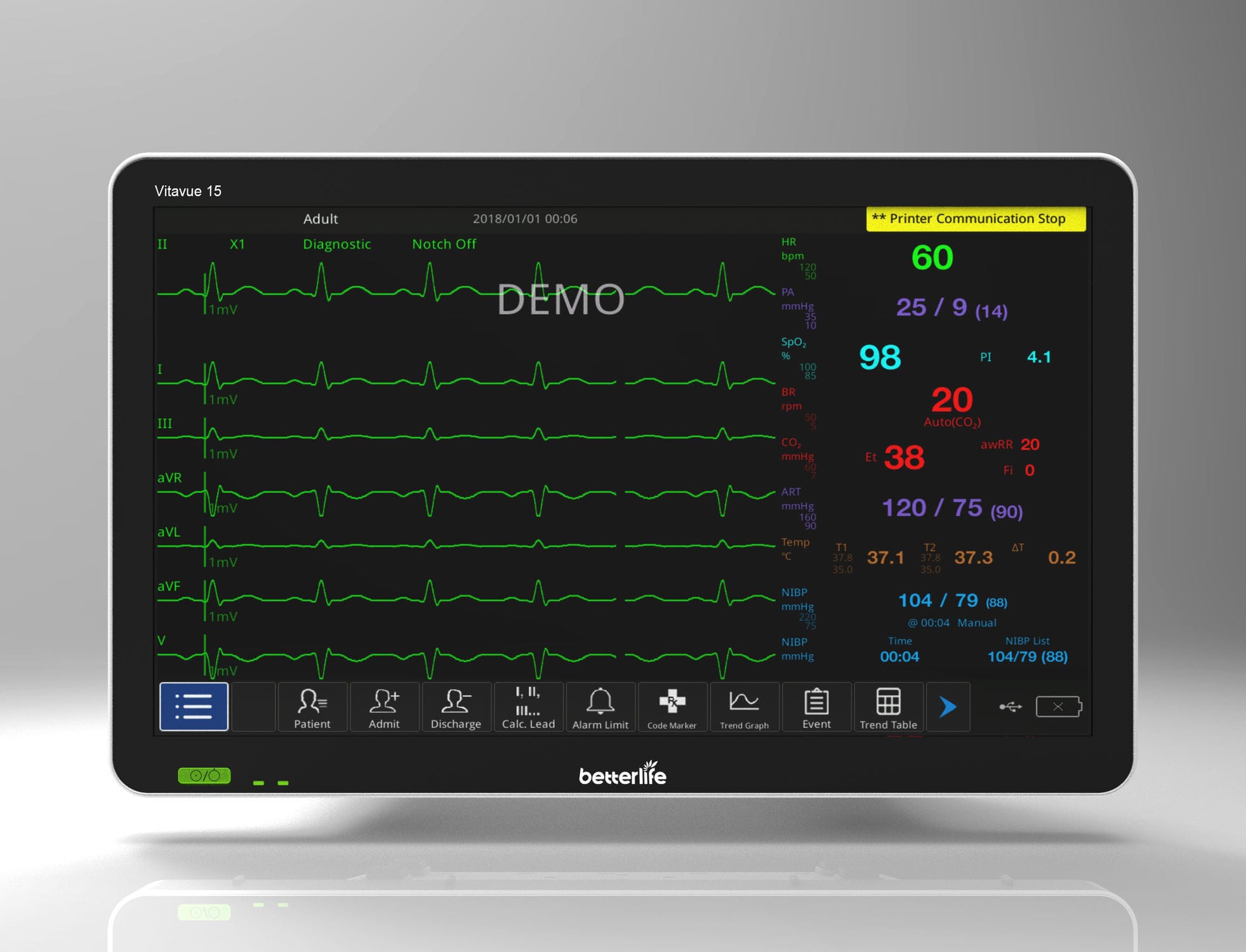 紧凑型多参数监护仪 VITAVUE 15 Better Life Medical Technology Co Ltd ECG