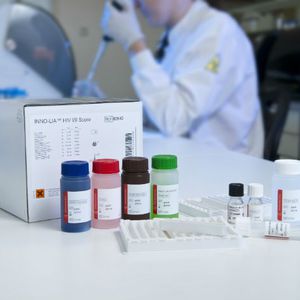 发光免疫测定快速诊断套装 / 传染病 / AIDS / 抗体