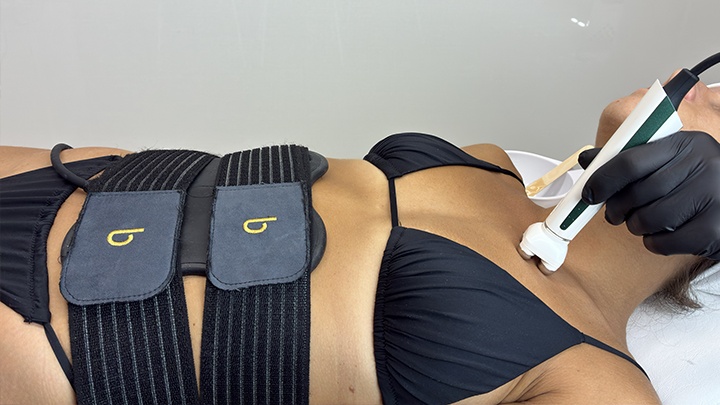 Brera Medical Technologies Photo 3