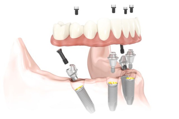 Nobel Biocare Services AG   Photo 2