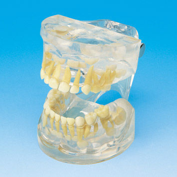 假牙解剖模型- PE-PDI001 - Nissin Dental Products Inc. - 教学/ 儿科