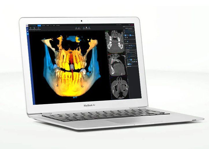 Planmeca romexis viewer недостаточно памяти для открытия 3d объема