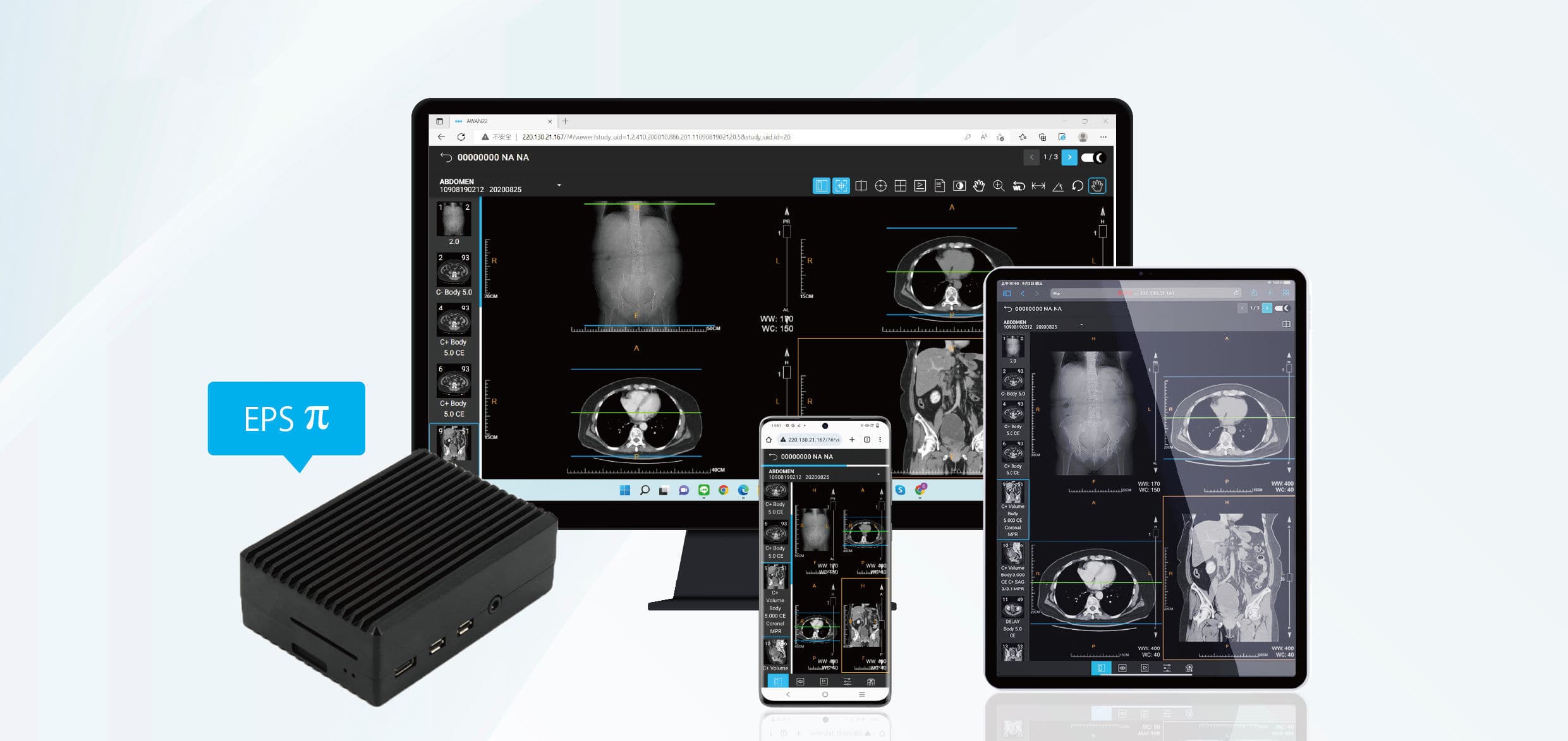 DICOM可视化软件- EPS Pi - EBM Technologies - 医用/ 医学成像/ Linux