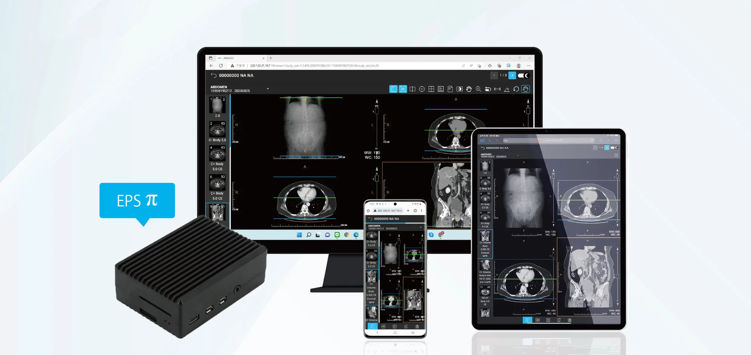 DICOM可视化软件- EPS Pi - EBM Technologies - 医用/ 医学成像/ Linux