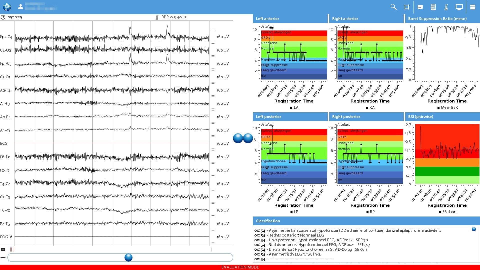 医疗可视化软件 / 分析 / 脑电图用 / 用于电生理检查