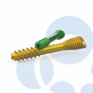 小骨碎片加压接骨螺钉 1