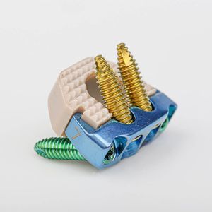 颈椎间融合器 1
