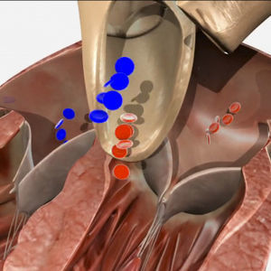 超声心动图检查模拟模块 1