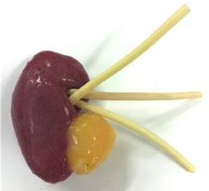 肾脏解剖模型