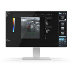 Intel® Core i7医用电脑