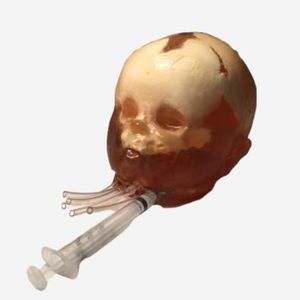 放射造影测试体模 1