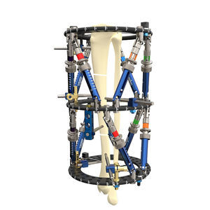 胫骨外固定架