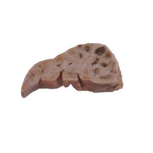 肝脏解剖模型