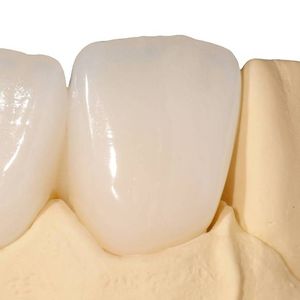 树脂材质牙科材料 1