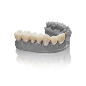 3D打印牙科材料