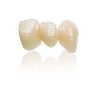 玻璃陶瓷牙科材料 1