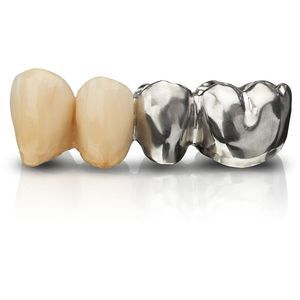 钴铬合金牙科材料 1