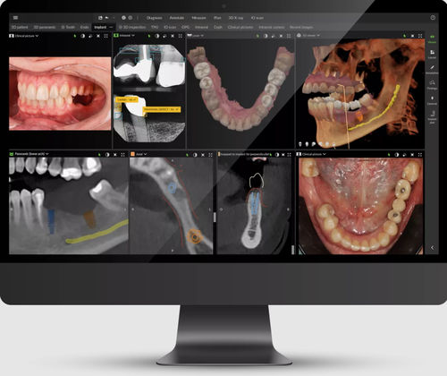临床软件 - DTX™ Studio - DEXIS - 牙科 / 用于牙科造影 / 管理