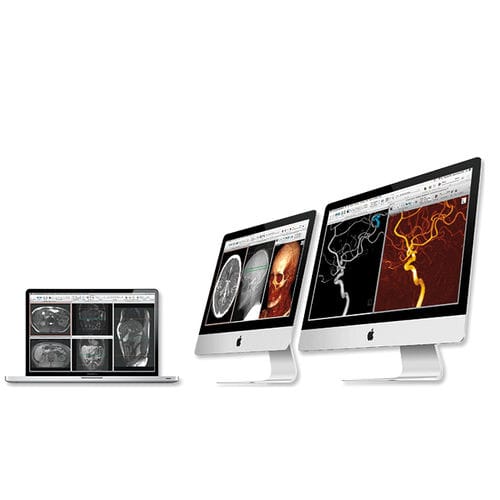 后处理软件 - aycan Medical Systems - 3D 可视化 / 诊断 / 评估