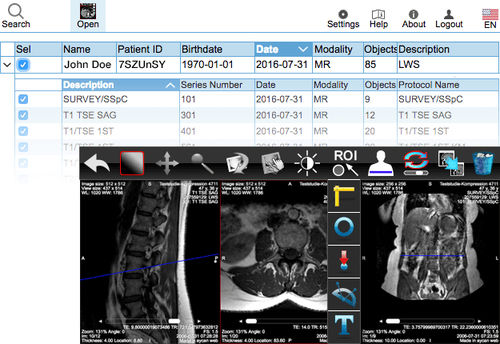 共享Web应用程序 - aycan Medical Systems - DICOM可视化 / 医学成像 / 基于网络