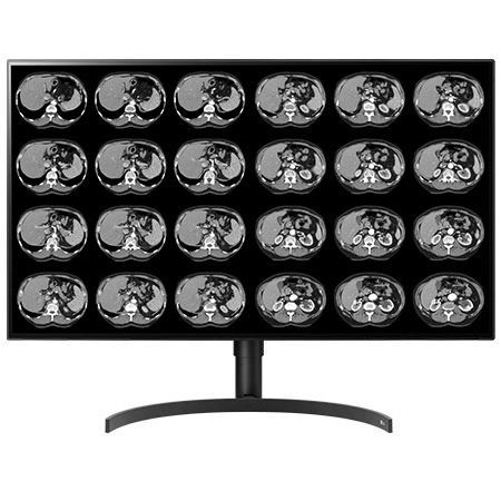 医用显示器 - CL8MPS32C - Double Black Imaging - 诊断 / 3840 × 2160 / 32"
