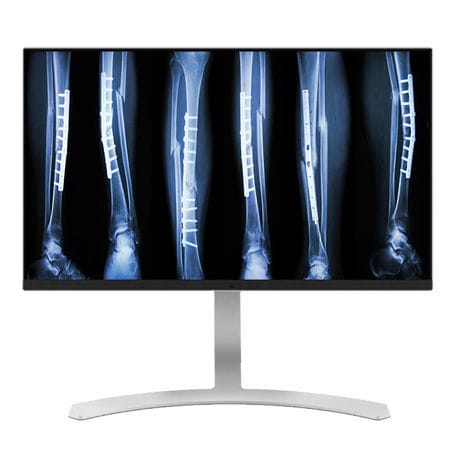医用显示器 - CL8MPS - Double Black Imaging - 诊断 / 3840 × 2160 / 27"