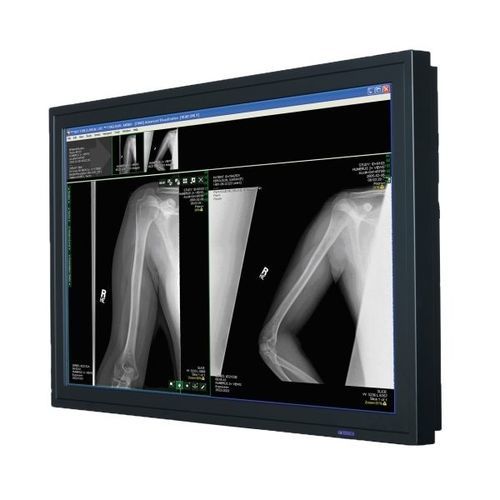 医用显示器 - FP4204B - Double Black Imaging - 手术室 / 内窥镜 / 手术