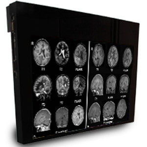医用显示器 - DBI24 - Double Black Imaging - 1920x1200 / 24" / 液晶