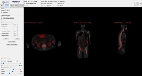 质量控制软件 - SUV SPECT® - Hermes Medical Solutions, Inc - 采集 / 确认 / 临床