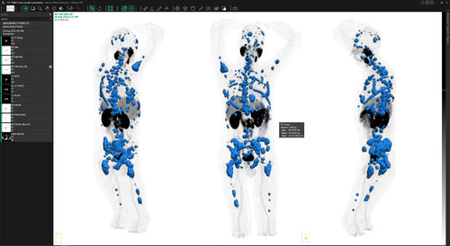 加工软件 - Voxel dosimetry™ - Hermes Medical Solutions, Inc - 确认 / 临床 / CT计算机断层扫描