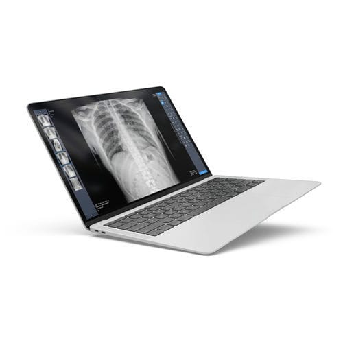 放射学软件 - ExamVue Duo - JPI Healthcare Solutions - 分析 / 管理 / 诊断