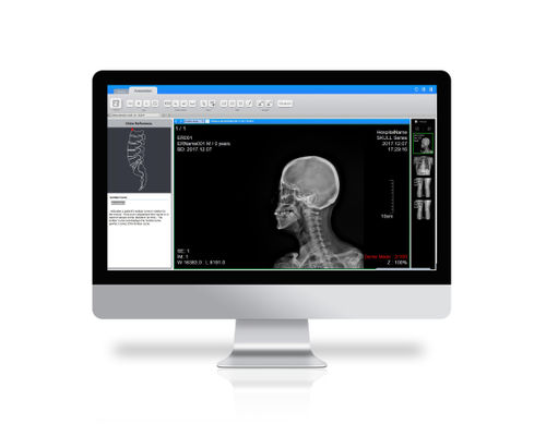 医学成像PACS系统 - ExamVue - JPI Healthcare Solutions