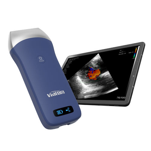 手持式B超机 - Shenzhen Viatom Technology Co., Ltd. - 用于多功能超声检查 / 肺栓塞 / 黑白