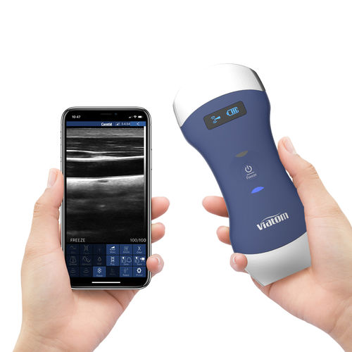 手持式B超机 - Viatom Dual Head - Shenzhen Viatom Technology Co., Ltd. - 用于多功能超声检查 / 黑白 / 彩色多普勒