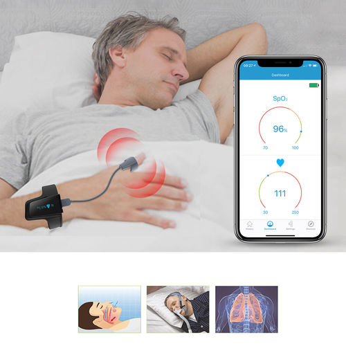 腕部脉搏血氧仪 - checkme o2 max - Shenzhen Viatom Technology Co., Ltd. - CPAP疗法 / 居家护理 / 睡眠呼吸障碍症