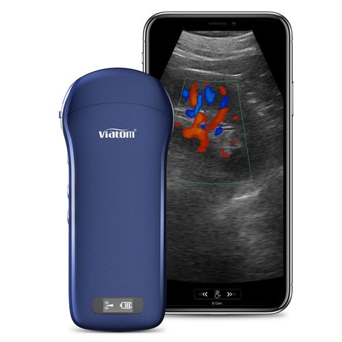 手持式B超机 - C10 - Shenzhen Viatom Technology Co., Ltd. - 用于多功能超声检查 / 黑白 / 彩色多普勒