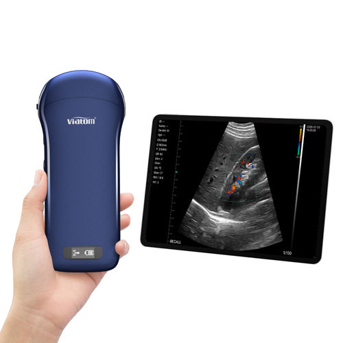 手持式B超机 - C10   - Shenzhen Viatom Technology Co., Ltd. - 用于多功能超声检查 / 黑白 / 彩色多普勒