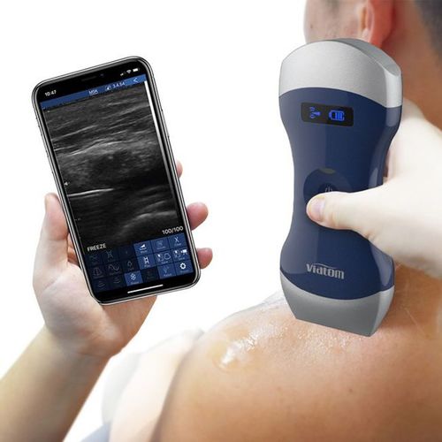 手持式B超机 - Uprobe-C 4PL - Shenzhen Viatom Technology Co., Ltd. - 用于多功能超声检查 / 黑白 / 彩色多普勒