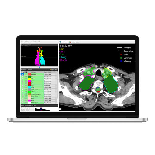放射疗法软件 - StructSure™ - Standard Imaging - 分析 / 测试 / 用于扫描身体轮廓