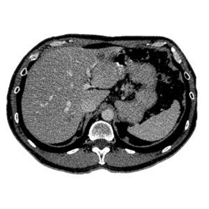 加工软件 - MeVis Medical Solutions AG - 教学用 / 医用 / 医学成像