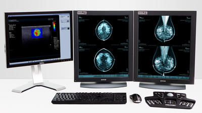 分析软件 - MeVis Medical Solutions AG - 诊断 / 规划 / CAD