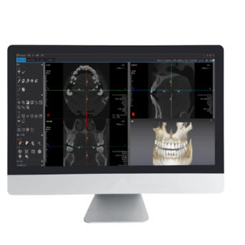 分析软件 - Dentiq 3D - 3D Industrial Imaging, Co., Ltd. - 3D 可视化 / 诊断 / 治疗计划制定