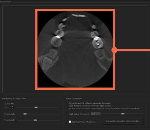 图像分析软件 - DentiqRecon - 3D Industrial Imaging, Co., Ltd. - 医用 / CT计算机断层扫描