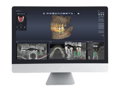 医学规划软件 - Dentiq Guide - 3D Industrial Imaging, Co., Ltd. - 数据管理 / 设计 / 捕获