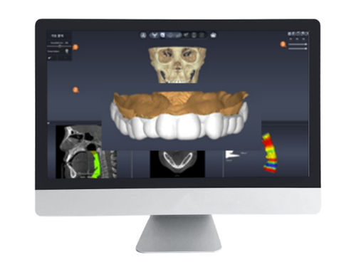 医用设计软件 - DentiqAir - 3D Industrial Imaging, Co., Ltd. - 医用 / 牙科