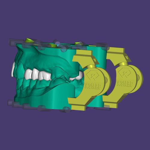 口腔移植手术软件模块 - xSNAP® - Champions Implants GmbH - 模型制作