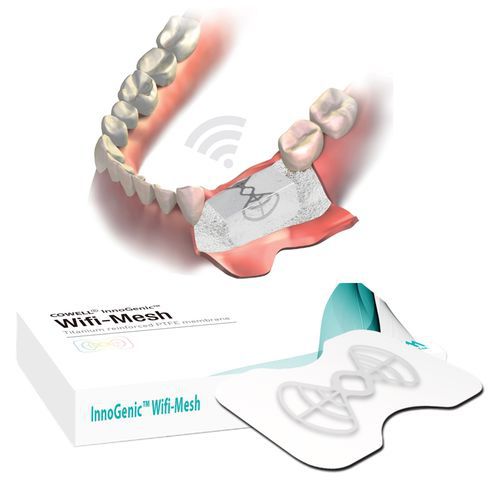 牙科手术组织基质 - InnoGenic™ Wifi-Mesh - Cowellmedi - PTFE