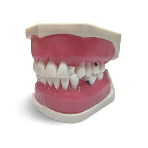 牙龈解剖模型 - E56 - GF DENTAL - 假牙 / 口腔护理 / 教学