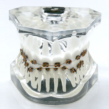 假牙解剖模型 - OTB6 - GF DENTAL - 牙齿矫正 / 培训 / 树脂