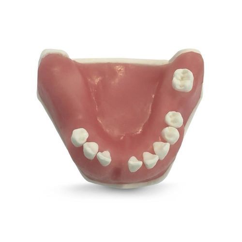 下颚解剖模型 - E39 - GF DENTAL - 牙科 / 牙移植术 / 培训